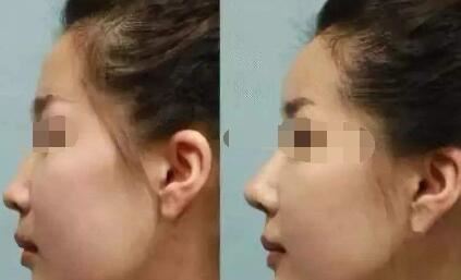 曾丽华