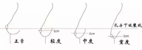 王智