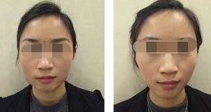 刘婧洁