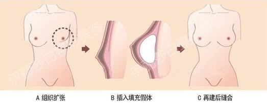 樊东力
