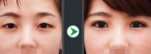 樊东力