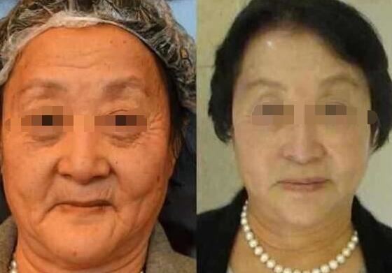 李生来