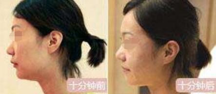 张晓娟