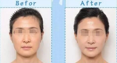 秦宏智