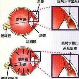夏丽坤