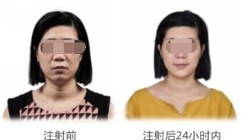 姜鸿雁