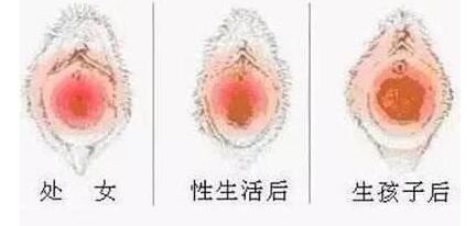 李秀梅