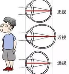 闫鲁娟