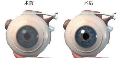闫鲁娟