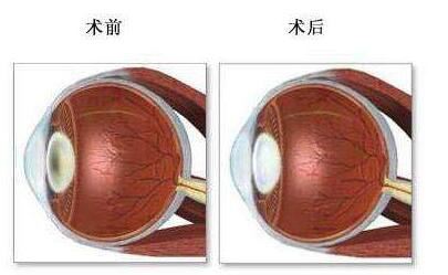 闫鲁娟