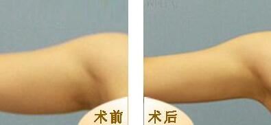 陆兴安