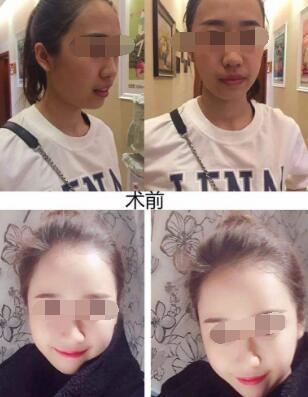 王颂锋
