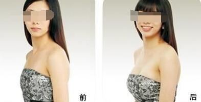 杨锴