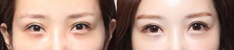 游小恩