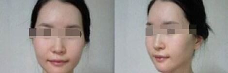汪春兰
