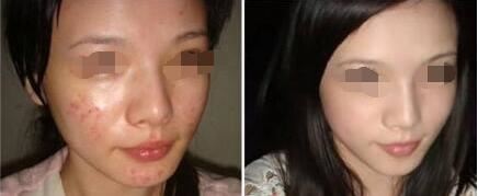许碧珠