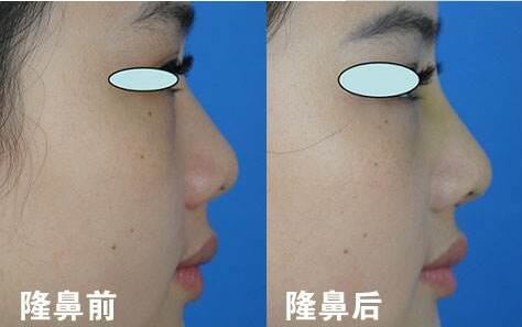龙云