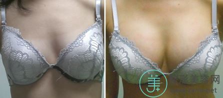 颜小武