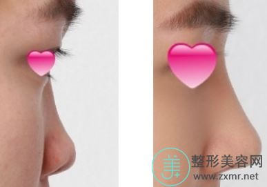 李久恒