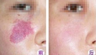 宋朝晖