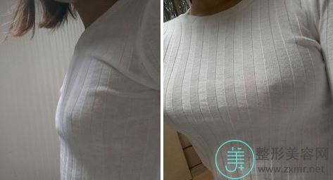 李正强