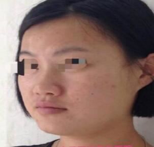 孙忠林