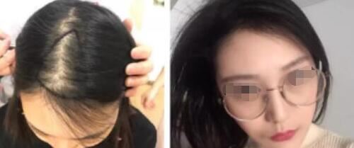 张敏