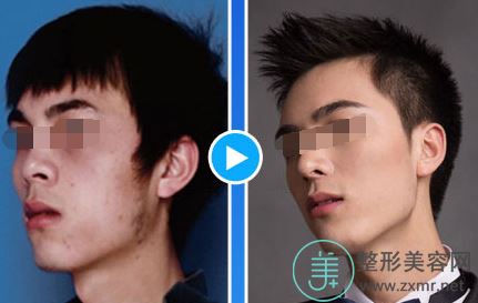 闫咏梅