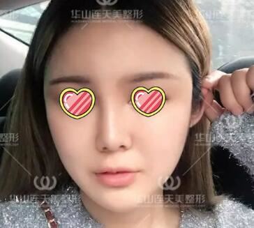 易晓轩