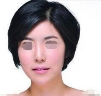 陈婷婷