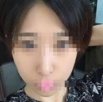 张忠旭