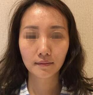 李超