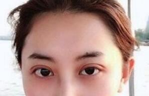 张月红