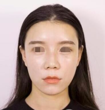 黄蕾