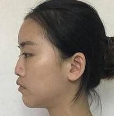 余刚