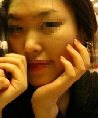邹佳