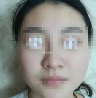 林蕾