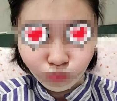 林蕾