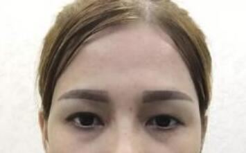林蕾