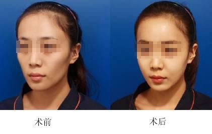 王维