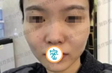 陈秀芸