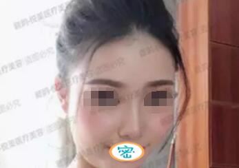 陈秀芸