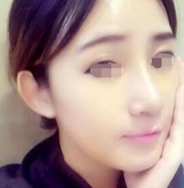侯兴春