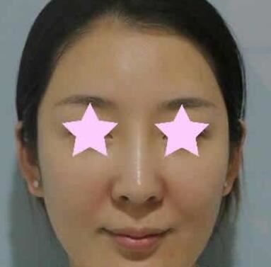 倪景辉