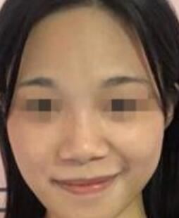李玲