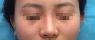 袁娜