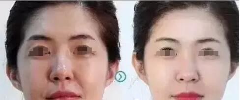 袁娜