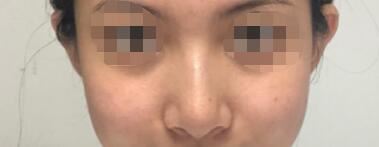 所健鹏