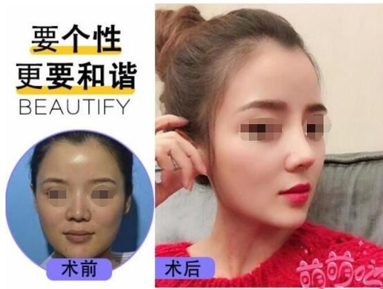 左晓云