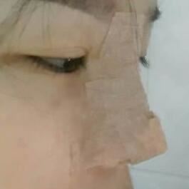 卢青
